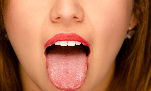 舌苔の取り方 はちみつ除去法まとめ まだ白い舌で良いの 神様の食材
